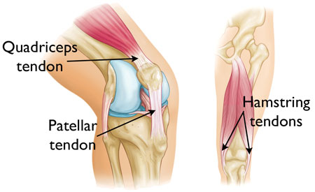 Common sources of ACL graft tissue