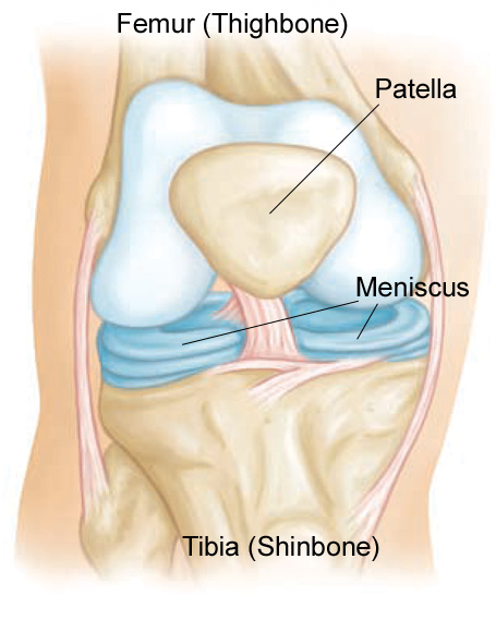 Front-view anatomical illustration of the knee showing the femur, tibia, patella and the two C-shaped menisci sitting between the thigh bone and shin bone