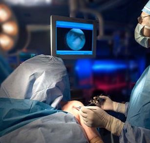 Arthrtoscopic Rotator Cuff Repair
