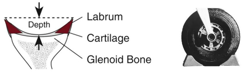 Labrum